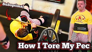 How I Tore My Pec! - A Meme Experience