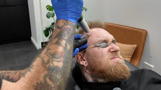 The Truth About Laser Tattoo Removal