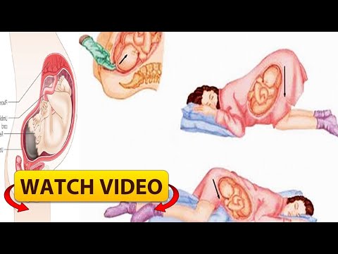 Proper Sleeping Position During Pregnancy You Must Know