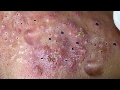 Relaxing Everyday With Loan Nguyen Skincare