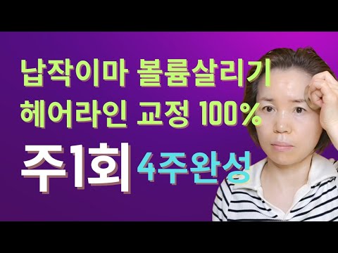 납작이마 볼륨살리기 넓은이마 헤어라인 교정 100% 가능한 이방법 주1회 4주완성!!