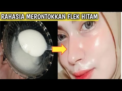 Nyesel Baru Coba Cara Ini!! Basmi Tuntas flek Hitam Diwajah Sebelum Terambat Cuma Pakai Ini