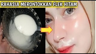 Nyesel Baru Coba Cara Ini!! Basmi Tuntas flek Hitam Diwajah Sebelum Terambat Cuma Pakai Ini