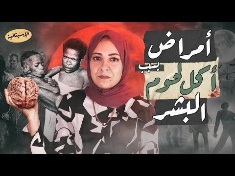 أمراض بسبب أكل لحوم البشر ! | أغرب كائن مسبب للأمراض في تاريخ الطب