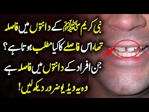 Meaning Of Gap Between Teeth Urdu Hindi - Prophet SAW K Dantoun Main Fasla Tha  || Urdu Lab