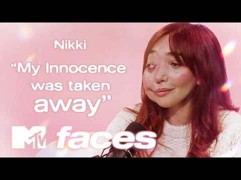 “I Still Get Stared At”: Nikki Lilly on Abusive Comments & Facial Differences | Faces: Body Image