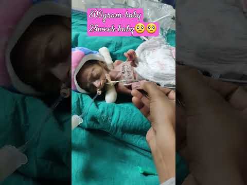 800 ग्राम और 28 हफ्ते का बेबी🥺🥺🥹🥹🥹🥹🥹 #newbornbaby #hospital #newborn #baby
