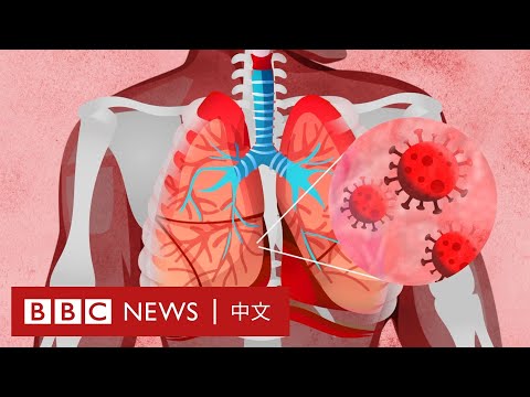 肺炎疫情：新冠病毒如何影響我們的身體？－ BBC News 中文 - YouTube(2:57)