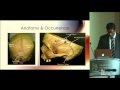 Wormian Bones and Their Implications