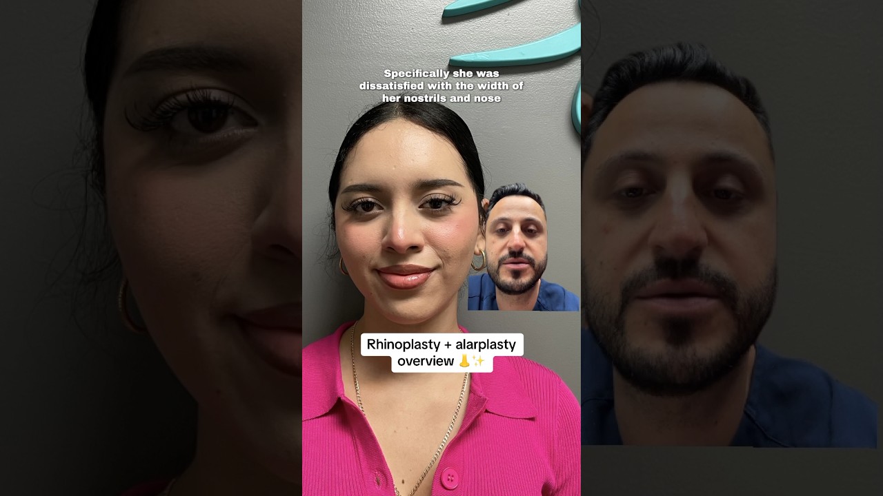 Rhinoplasty consultation and overview discussion.