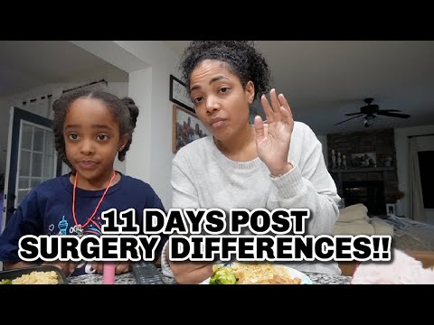 11 DAY POST SURGERY DIFFERENCES!