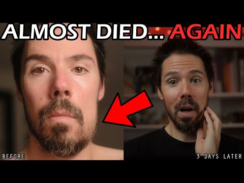 I Almost Died... AGAIN! (From a Tooth This Time)