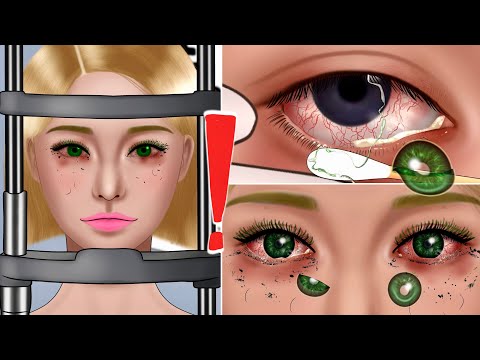 ASMR Removal of Eye Mucus String & Many Contact Lenses Animation‼️, Blackhead, Insideout Makeup