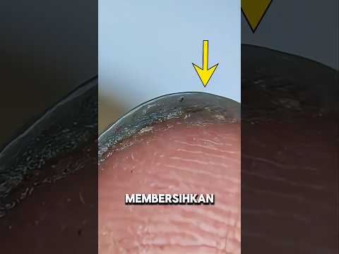 betapa banyak bakteri di kuku kita saat di mikroskop⁉️😱