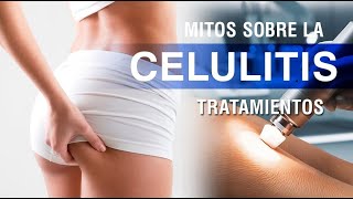 Celulitis: Mitos más comunes | Tratamientos