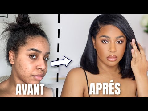 COMMENT JE CAMOUFLE MON ACNÉ, TACHES, CERNES (ET MES PÉCHÉS)