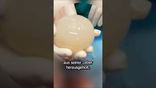 Deutschlands gefährlichster Parasit #shorts