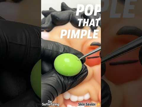 ✨ 작은 소리 하나에, 마음이 편안해져요 | Tiny Pop, Deep Calm #blackheads #satisfyingvideo #skincare