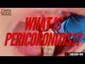Understanding Pericoronitis and Wisdom Teeth
