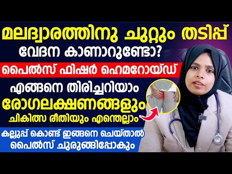 മലദ്വാരത്തിനു ചുറ്റും തടിപ്പ് വേദന കാണാറുണ്ടോ?കല്ലുപ്പ് കൊണ്ട് ഇങ്ങനെ ചെയ്താൽ പൈൽസ് ചുരുങ്ങിപ്പോകും