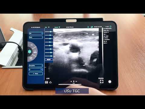 Wireless-Ultrasound-Konted