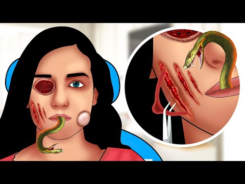 ASMR Facial care for Girl | Skincare Treatment  Animation | Removal Worms, Maggots, Dog Ticks