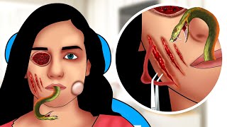 ASMR Facial care for Girl | Skincare Treatment  Animation | Removal Worms, Maggots, Dog Ticks
