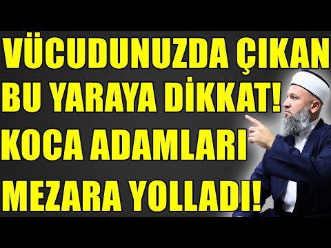 BU HASTALIK KOCA ADAMLARI DEVİRDİ! ŞU 3 HASTA ZİYARET EDİLMEZ! Hüseyin ÇEVİK