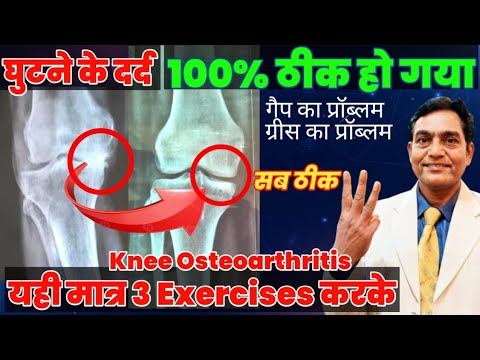 सिर्फ 3 Exercises कर के घुटने का दर्द 100 % ठीक हुआ | knee pain exercises | ghutne ke dard ka ilaj