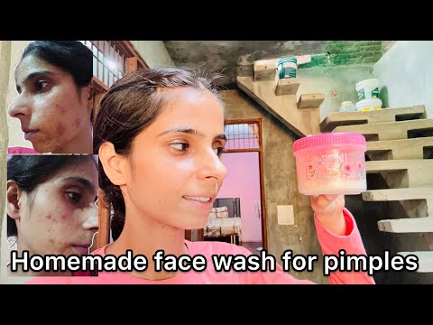 Homemade face wash for pimples 😀😀 #punjabivlogs #punjabivlogger #punjabivlog #punjabivideo