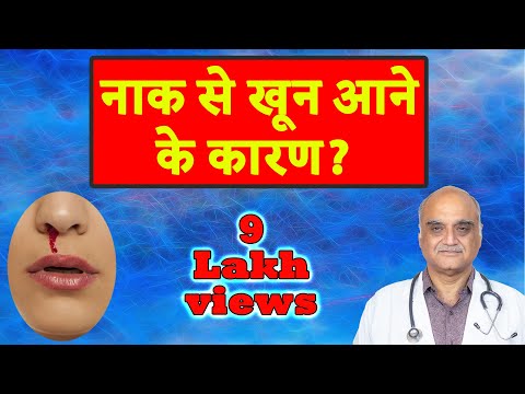 नाक से खून क्यों आता है । Why blood comes from nose । Hindi । डॉ राजीव भाटिया