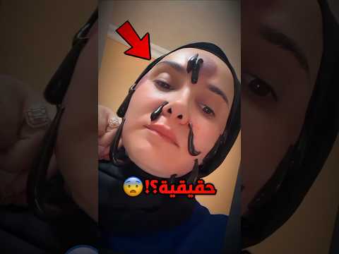 كيف ستتصرف إذا حدث لك مثل هذا !! 😨 #short #shortvideo