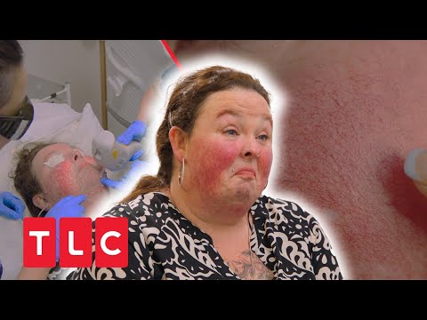 Ihre Haut brennt wie Feuer!! | Dr. Emma - Hautärztin aus Leidenschaft | TLC Deutschland