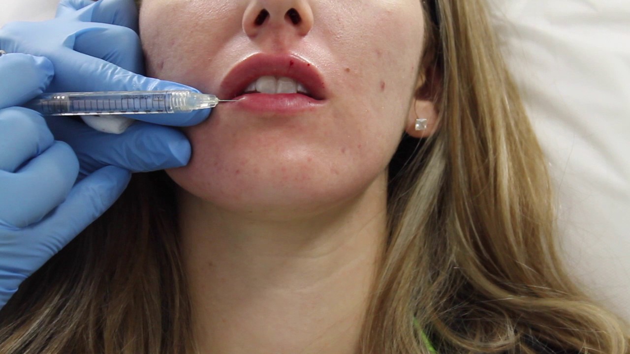 Patient receiving facial treatment in clinic setting.