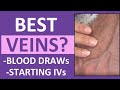 Identifying Optimal Veins for Venipuncture Procedures