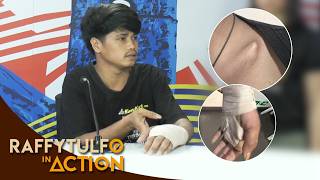 WELDER, NAIPIT ANG KAMAY DAHIL SA TRABAHO!