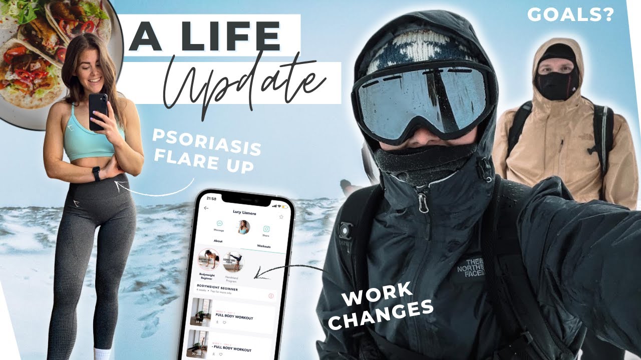 Why I've Been Struggling: Work-Life Balance & Psoriasis Flare Update - A Lil' Heart to Heart