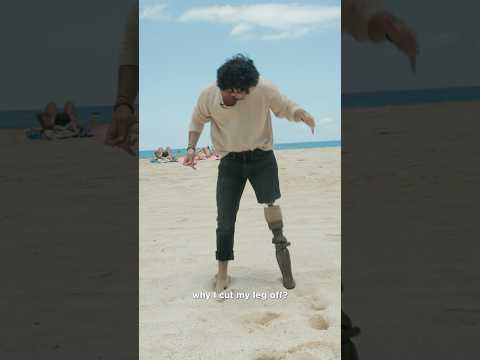 The BEST REASON on why I cut my leg off?!