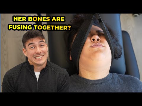 Treatment for Ankylosing Spondylitis