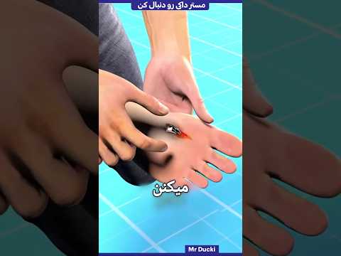 چطور شیشه‌ای که توی پا گیر کرده رو دربیاریم! 😱