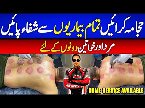 Cupping Therapy at Home | My First Hijama Experience @AbbasKaPakistan