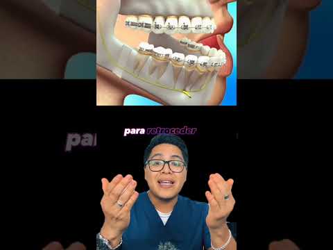 dientes que cambian rostros #dientes #dentista #tips #parati #viral #fyp #shorts #shortvideo #fypシ