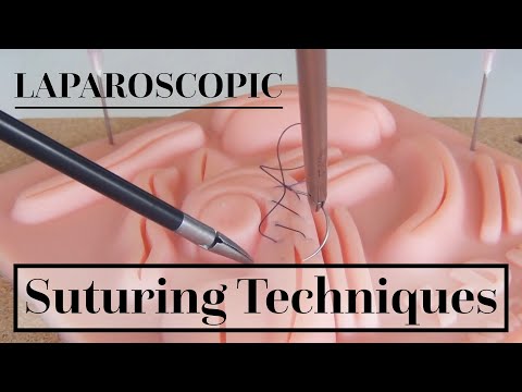 Laparoscopic Suturing Techniques