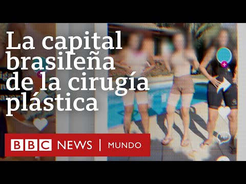 Cómo es la ciudad en Brasil que se volvió viral por sus ofertas de cirugías plásticas