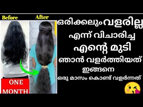 ഒരിക്കലും വളരില്ല എന്ന് വിചാരിച്ച എൻ്റെ മുടി വളർത്തിയത് ഇങ്ങനെ