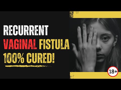 Australian Recurrent RVF Vaginal Fistula cured with Dr Porwals 4 Layered Sphincter Saving Surgery