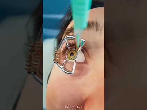 Eye operation done by mistake 🤢 #shortvideo