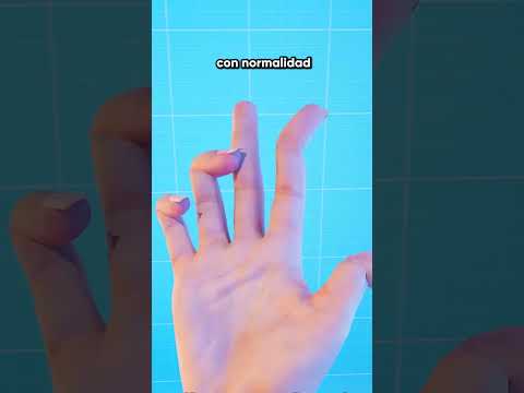 ¿Es Posible Sobrevivir sin Huesos?
