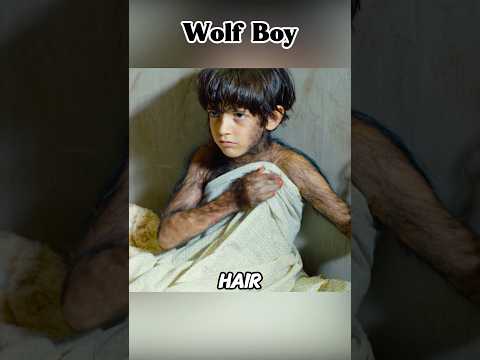 This boy turns into a wolf boy when he sees the full moon！#shorts #fantasy #adventure