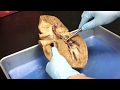 Heart Anatomy and Function Assessment